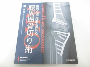 ●01)【同梱不可】膝周囲骨切り術/AKO/竹内良平/日本医事新報社/2022年/シリアルナンバー未開封/A