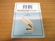 ●01)【同梱不可】骨折/髄内固定治療マイスター/澤口毅/メジカルビュー社/2022年発行/A_画像1