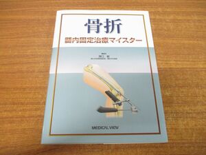 ●01)【同梱不可】骨折/髄内固定治療マイスター/澤口毅/メジカルビュー社/2022年発行/A