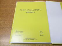 ▲01)【同梱不可】TOOTH WEAR/保存・修復の真髄を求めて/Debora R Vilaboa/クインテッセンス出版/2023年発行/A_画像4