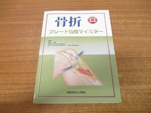 ▲01)【同梱不可】骨折/プレート治療マイスター/改訂第2版/澤口毅/メジカルビュー社/2023年発行/A