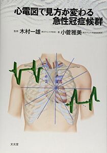 [A01638348]心電図で見方が変わる急性冠症候群