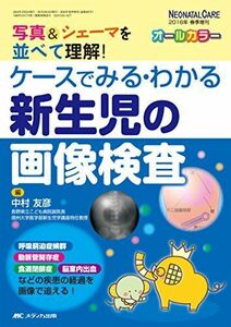 [A01439705]ケースでみる・わかる 新生児の画像検査: 写真&シェーマを並べて理解! (ネオネイタルケア2016年春季増刊)