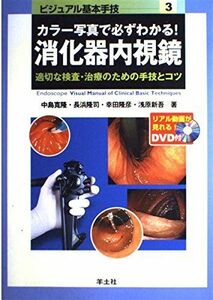 [A01057216]カラー写真で必ずわかる!消化器内視鏡: 適切な検査・治療のための手技とコツ (ビジュアル基本手技 3)