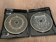 BABYMETAL Download Festival UK 2018 Blu-ray_画像2