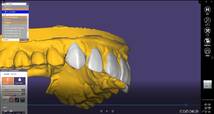 歯科　歯科技工　デジタルデンタルパーツ　スマイルデザイン用　カラーテンプレート＋ラインテンプレート＋ゴールデンプロポーションガイド_画像8