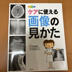 ケアに使える画像の見かた X線写真・CT画像・エコー像・MRI 久志本成樹/編著
