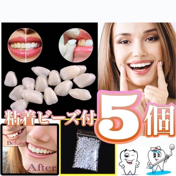 歯科技工 インスタントスマイル つけ歯 義歯 仮歯 差歯 歯の修復キット 超薄型 ナチュラルカラー 前歯用ランダム5枚 粘着ビーズ付 1