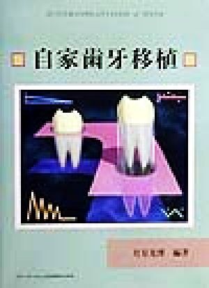 自家歯牙移植/月星光博(著者)