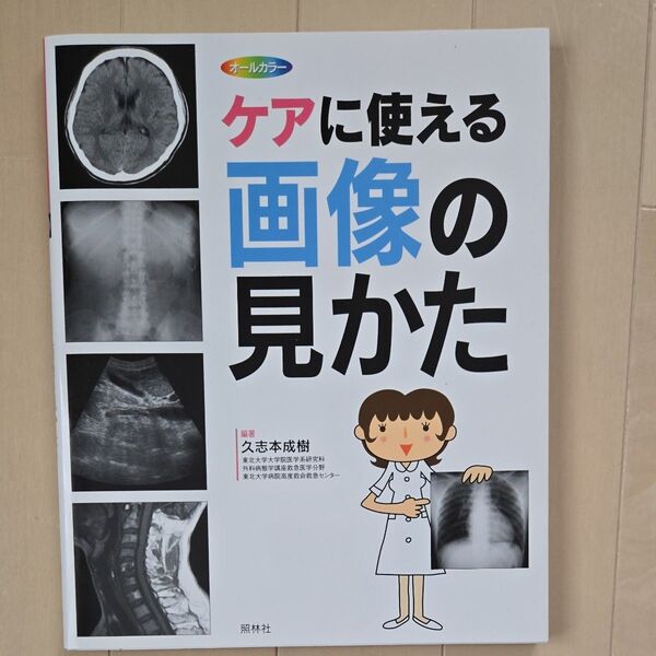 ケアに使える画像の見かた X線写真・CT画像・エコー像・MRI 久志本成樹/編著
