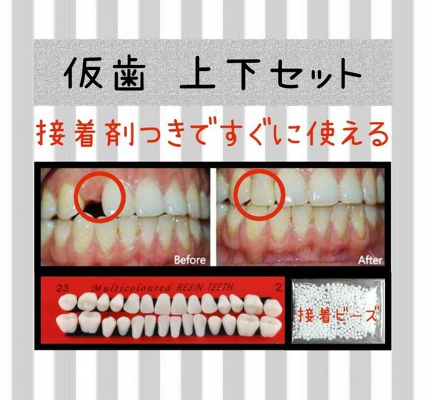 【新品未使用】歯の応急処置 仮歯のフルセット つけ歯