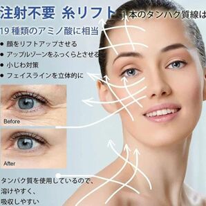 刺さない溶ける糸リフト 12本入り×5袋 値下げしました☆