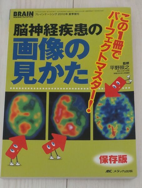 脳神経疾患の画像の見かた ブレインナーシング メディカル出版