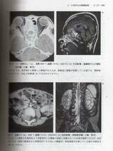 小児がん 医薬ジャーナル社　 (小児科 小児外科 白血病 悪性腫瘍 小児癌　小児ガン_画像2