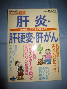 ☆肝炎・肝硬変・肝がん　治療法はここまで進んだ！　【健康】